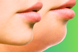 valor lipo de papada