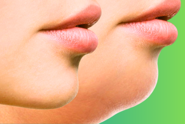 valor lipo de papada